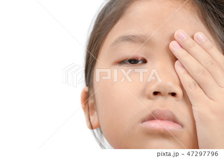 Close up of asian little girl one eye infection isolated Close up of asian little girl one eye infection isolated 47297796