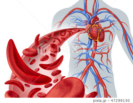 Sickle Cell Heart Circulation 47299130