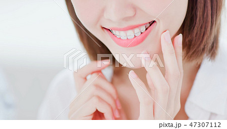 woman with retainer for teeth woman with retainer for teeth 47307112