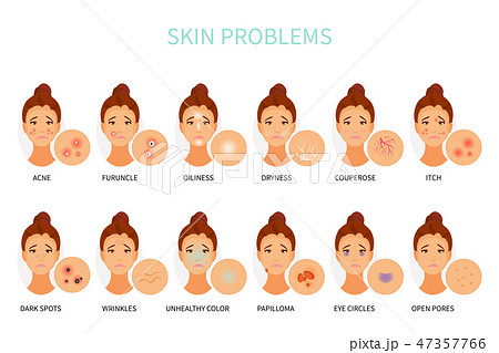 Skin problems vector 47357766