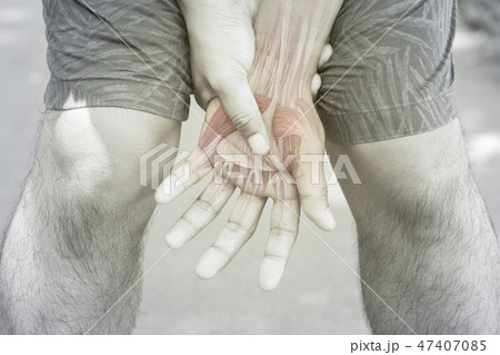 hand muscle pain 47407085
