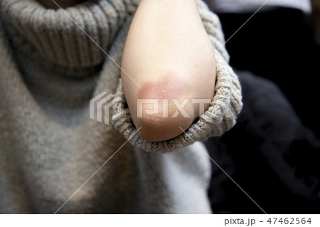 肘 身体 大人 47462564