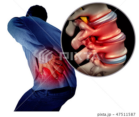 Lower Back Pain Lower Back Pain 47511587