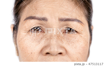 close up skin wrinkle old asian woman face 47513117