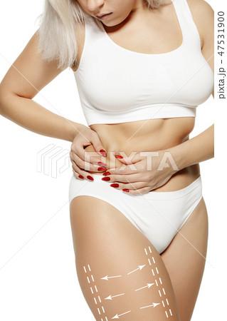 Female body with the drawing arrows. Fat lose, liposuction and cellulite removal concept 47531900