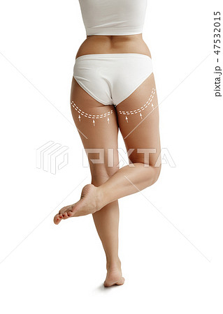 Female body with the drawing arrows. Fat lose, liposuction and cellulite removal concept Female body with the drawing arrows. Fat lose, liposuction and cellulite removal concept 47532015