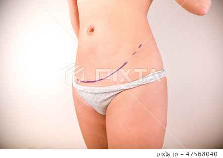 Surgeon drawing marks on female body before plastic operation, white background. Beautician touch Surgeon drawing marks on female body before plastic operation, white background. Beautician touch 47568040
