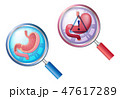 胃・ルーペイメージ 47617289