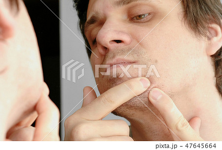 Young man squeezes the pimple on the face in front of the mirror. Closeup man's face with skin Young man squeezes the pimple on the face in front of the mirror. Closeup man's face with skin 47645664