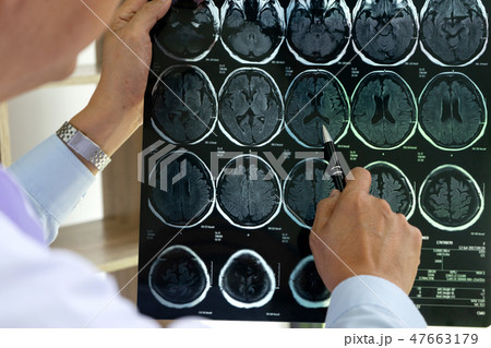 professional brain doctor give a counselor professional brain doctor give a counselor 47663179