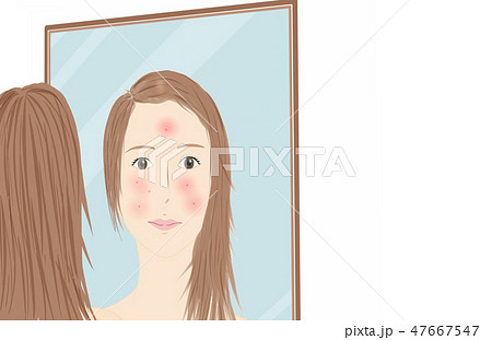 女性の肌の悩み イメージ 女性の肌の悩み イメージ 47667547