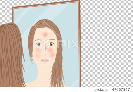 女性の肌の悩み イメージ 女性の肌の悩み イメージ 47667547