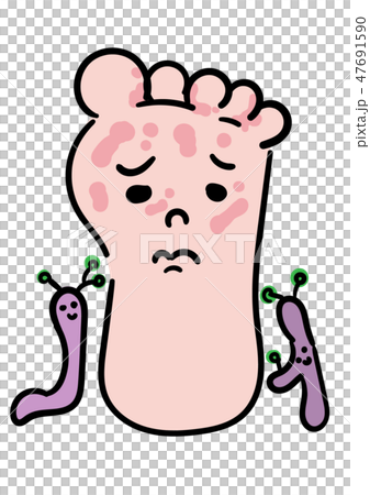 Asthma Asthma 47691590