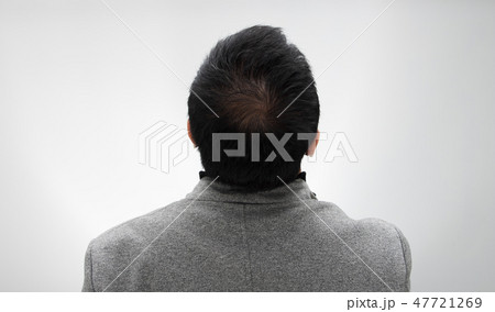 Aesthetics Doctor inject treatment serum vitamins to hair fall area on head by Syringe, Short Hair Loss control therapy clinic to prevent falling in working senior man woman, studio lighting isolated 47721269