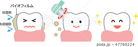 バイオフィルム除去　ビフォア　アフター 47760224