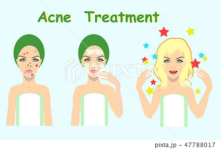 acne treatment before after, skin problem solution 47788017