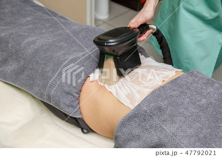 Сryolipolysis treatment. Nonsurgical fat reduction 47792021