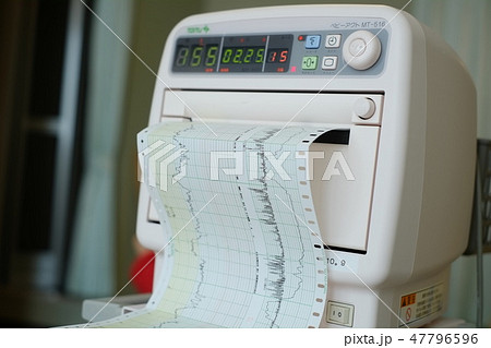 出産直前のNSTモニターの波形 47796596