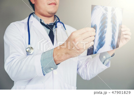 Doctor holding and checking chest x-ray film Doctor holding and checking chest x-ray film 47901829