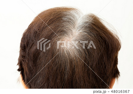 シニア 頭髪 シニア 頭髪 48016367