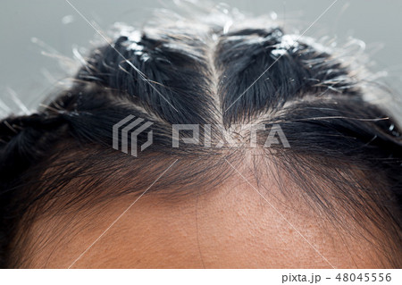 Body Part Hair root head skin close up woman Body Part Hair root head skin close up woman 48045556