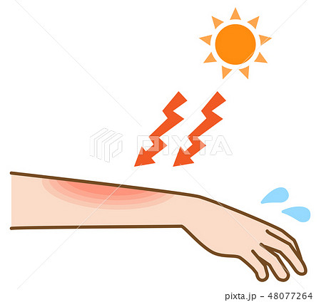 脱毛後の日焼けで炎症が起きる腕と太陽のイラストのイラスト素材