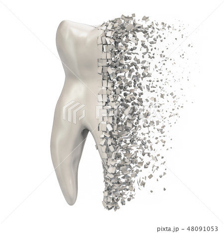 Tooth decay concept, 3D rendering 48091053