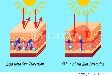 Two types of skin with and without sun protection, sunburn, vector illustration 48103752