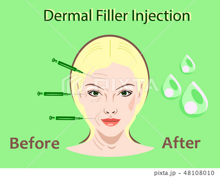 Cosmetic surgery vector illustration 48108010