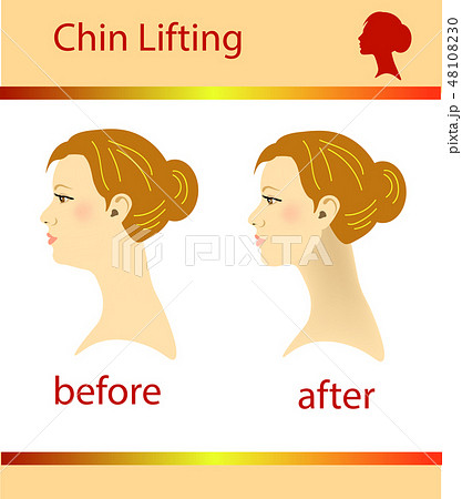 Illustration of a woman with a double chin Illustration of a woman with a double chin 48108230