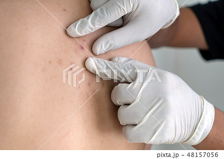 Woman Dermatologist examining birthmark of cal Woman Dermatologist examining birthmark of cal 48157056