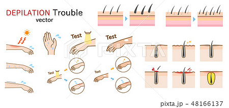 脱毛やムダ毛の自己処理の肌トラブル関連のベクターセット 48166137