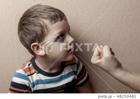 Family violence. Child abuse. Sad child with bruises under eyes adult man fist threatening. Family violence. Child abuse. Sad child with bruises under eyes adult man fist threatening. 48250481