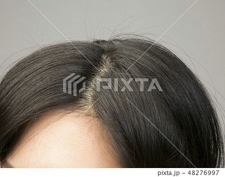 髪 女性 ヘアケア 美容 シャンプー 薄毛 育毛 分け目 白髪染め 痒み かゆみの写真素材