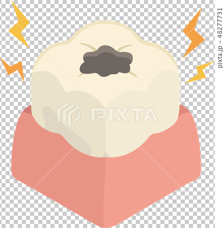 Carious tooth gums 48277731