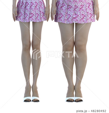 ダイエットイメージ　ビフォーアフター 48280492