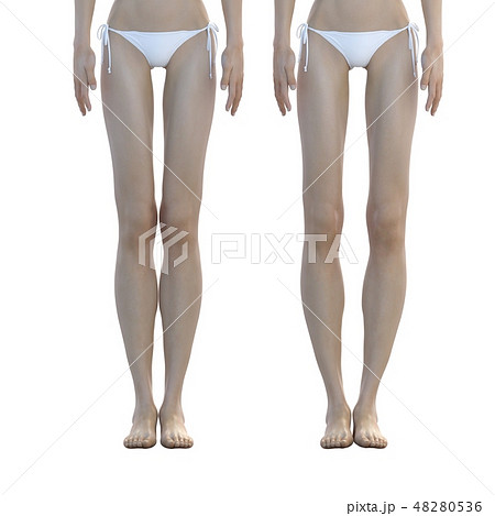 正常な脚とO脚の脚　ビフォーアフター 48280536