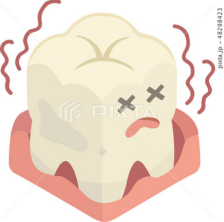 歯周病の歯 歯周病の歯 48298423