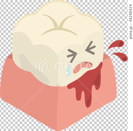 Bleeding gums 48298424