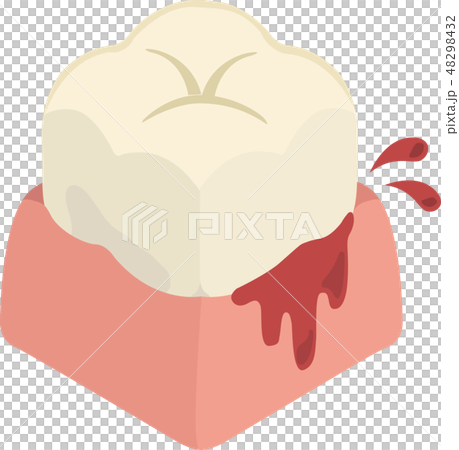 出血する歯茎 出血する歯茎 48298432