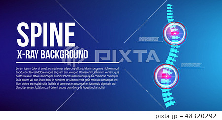 Creative vector illustration of spine x-ray, pain neck, disk degradation, injury treatment on 48320292