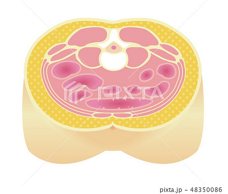 腹部断面図イラスト「肥満のタイプ」/ 皮下脂肪型肥満 48350086