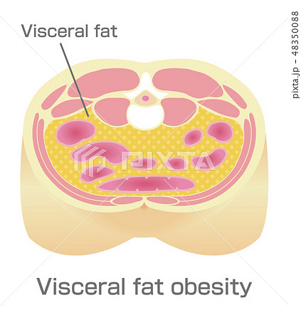 腹部断面図イラスト 肥満のタイプ 内臓脂肪型肥満 英語 のイラスト素材 4500