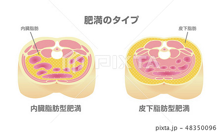 腹部断面図イラスト「肥満のタイプ」/ 内臓脂肪、皮下脂肪 48350096