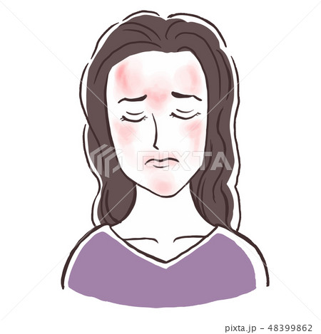 フェイス脱毛後の炎症 痛そうな表情 のイラスト素材