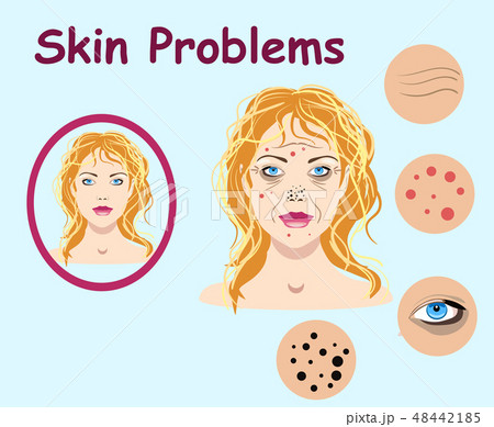 Female face skin problems. Vector illustration  48442185