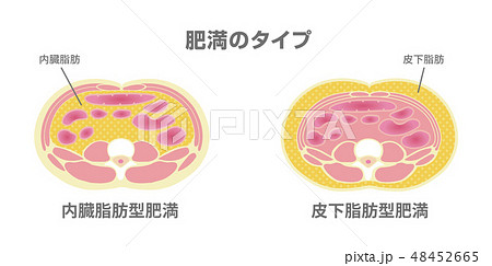 腹部断面図イラスト「肥満のタイプ」/ 内臓脂肪、皮下脂肪 48452665