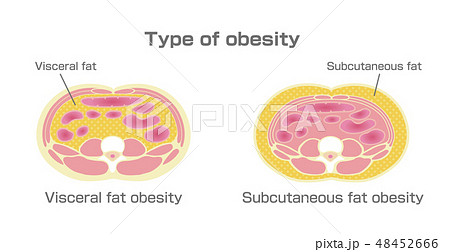 腹部断面図イラスト「肥満のタイプ」(英語）/ 内臓脂肪、皮下脂肪 48452666