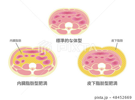 腹部断面図イラスト 肥満のタイプ 標準体型 内臓脂肪 皮下脂肪のイラスト素材