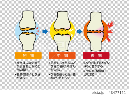 joint 48477131